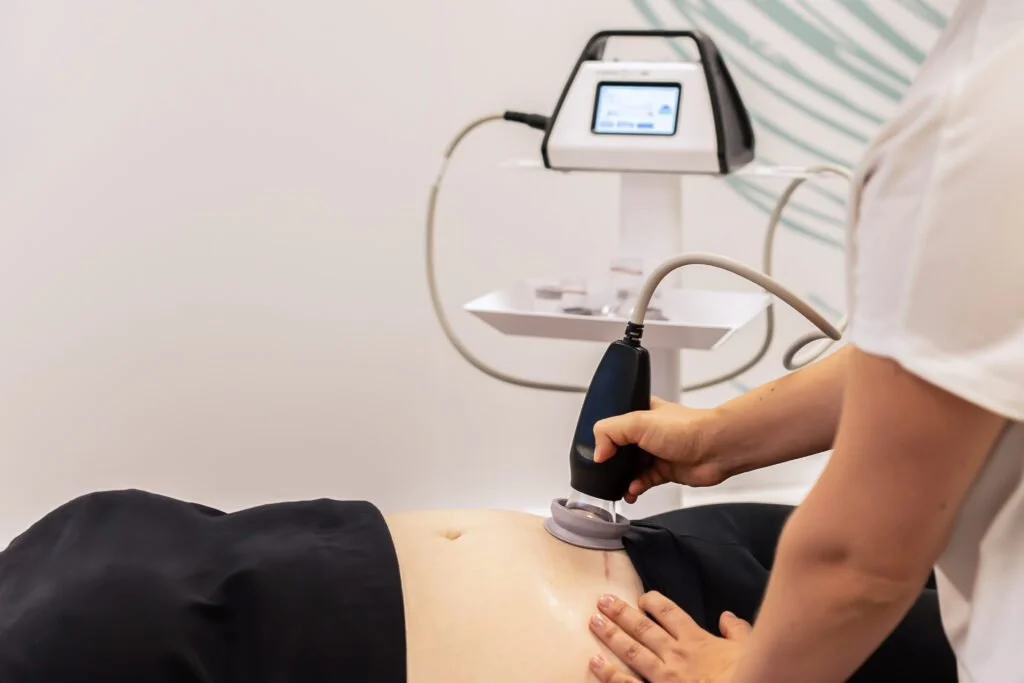 Physiotherapist uses a hand held device to perform scar therapy treatment on a female's abdomen. A monitor is linked to the device with a wire.
