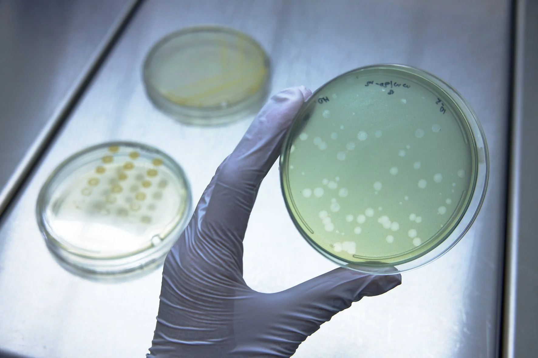 Viruses against bacteria: EU funds phage therapy with €15 million