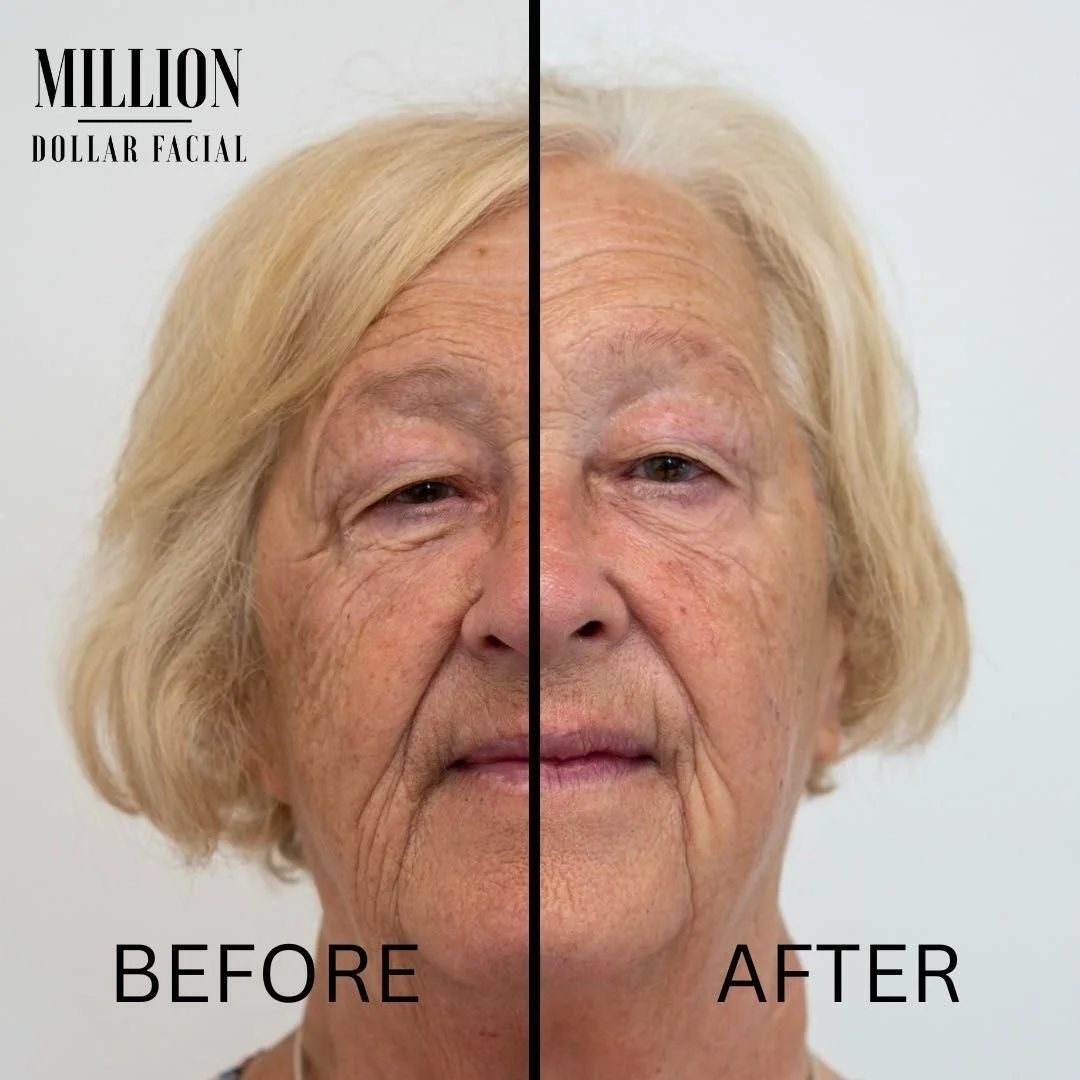 Million Dollar Miracle Mask