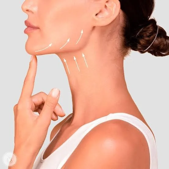 Nefertiti Neck Lift (Model)