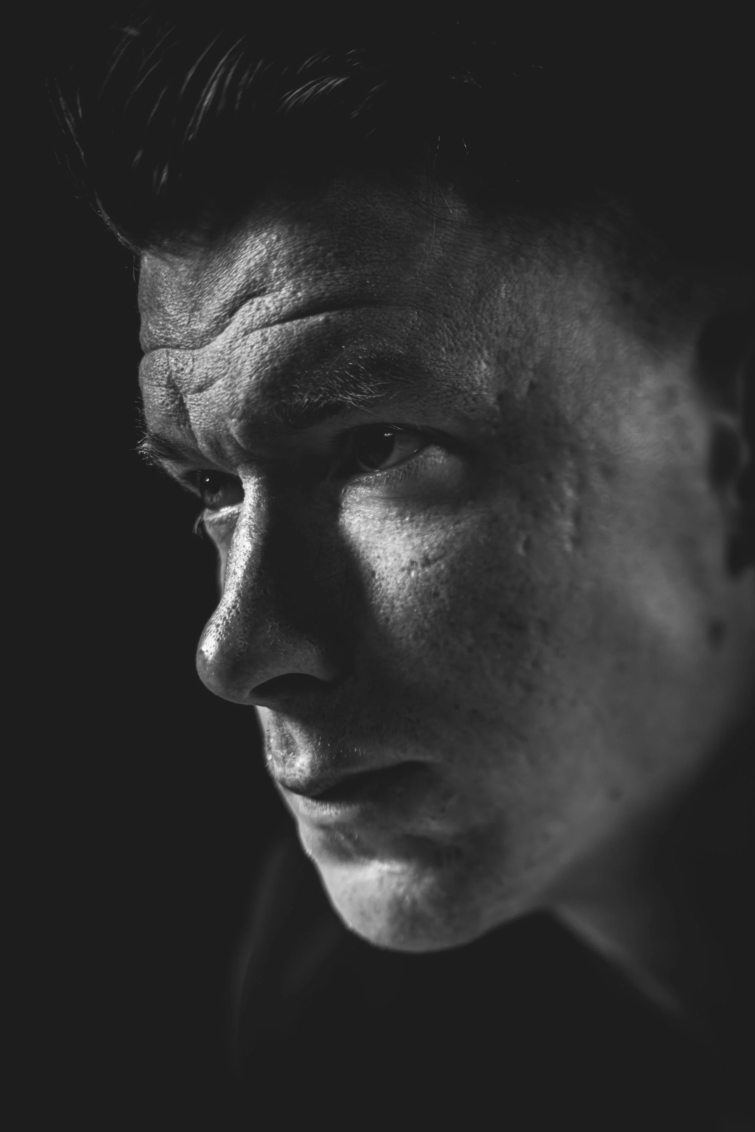 Close-up black and white photo of a person's face showing their eye, nose, forehead, and cheek with detailed skin texture, set against a dark background.