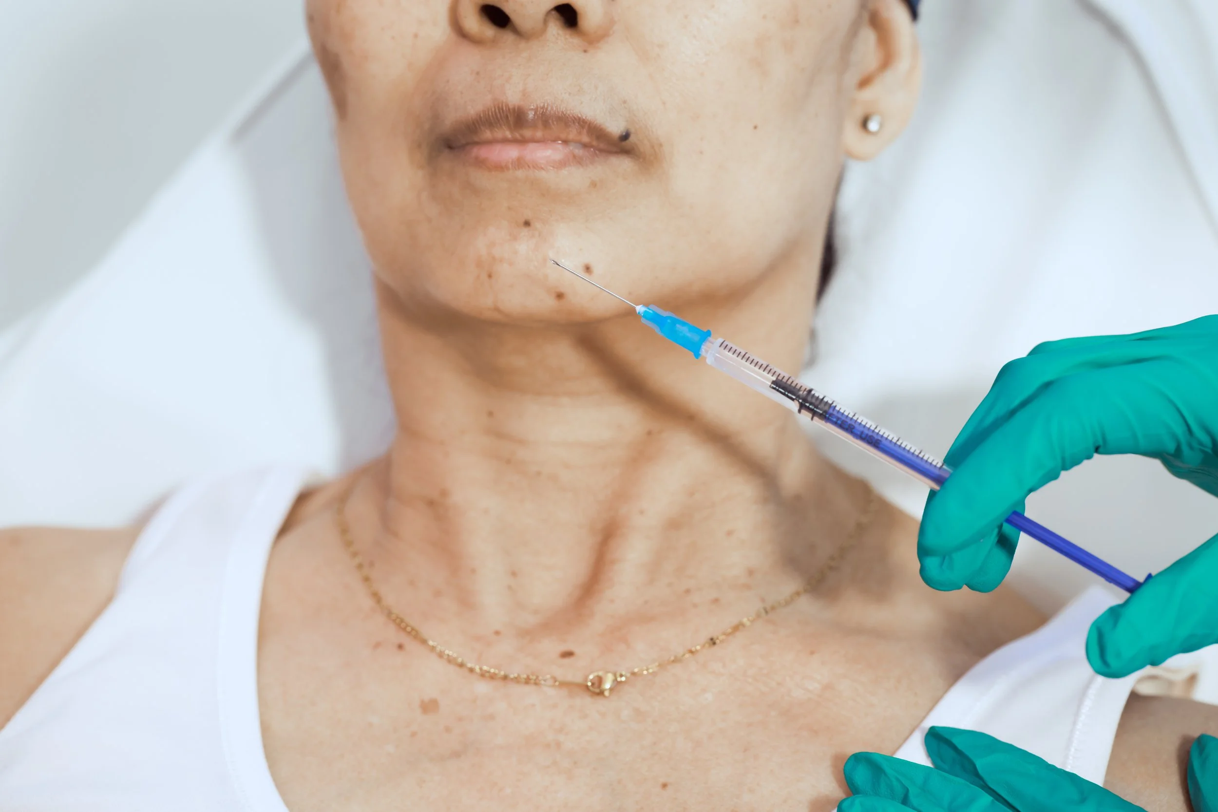 A person with light brown skin is lying down as a healthcare professional administers a vaccine injection into her upper arm. The person is wearing a white top, a gold necklace, and small earrings, and the healthcare worker is wearing green gloves.