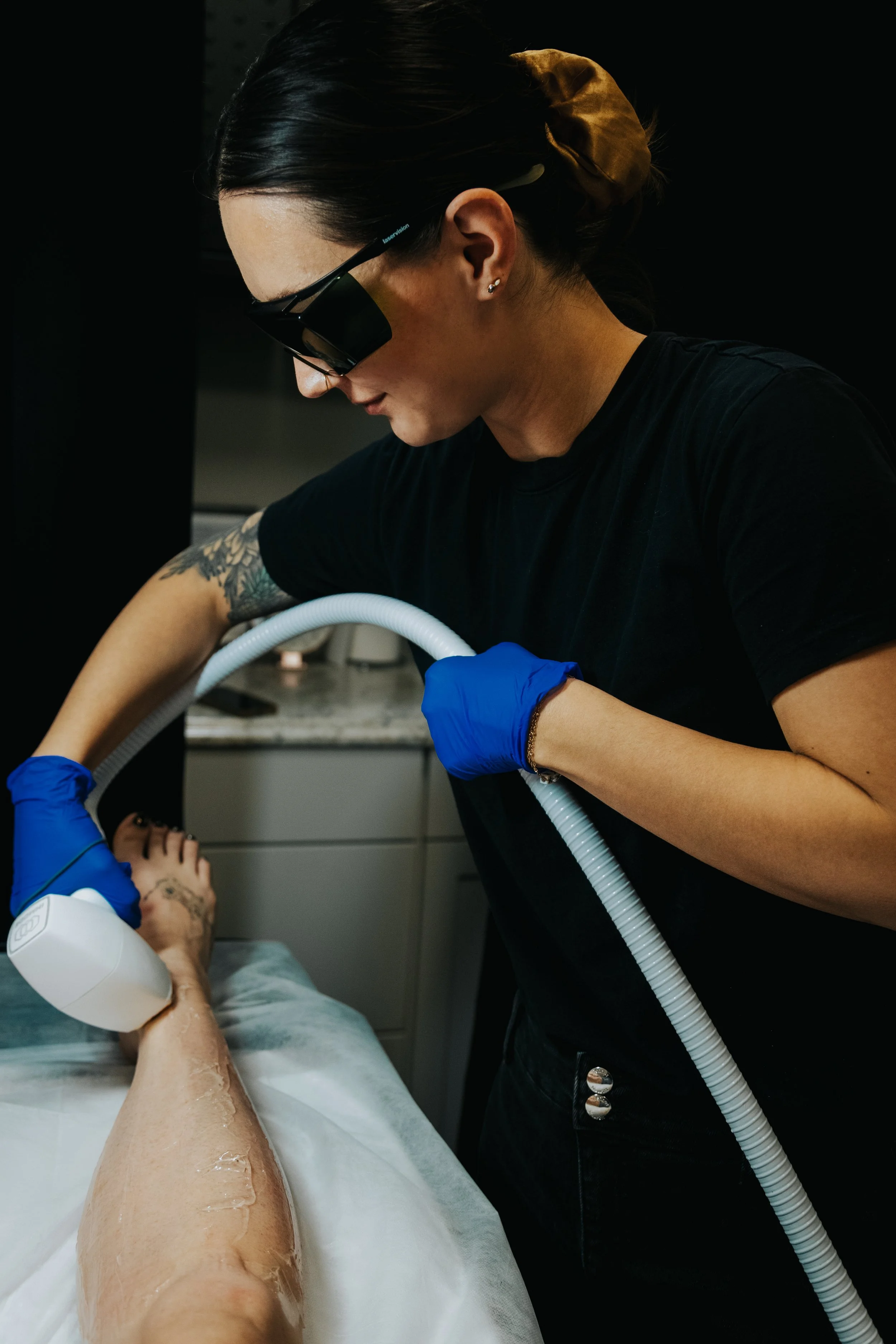 Laser hair removal treatment at NYBGC in Kaysville, Utah using professional medical laser technology for long-term hair reduction.