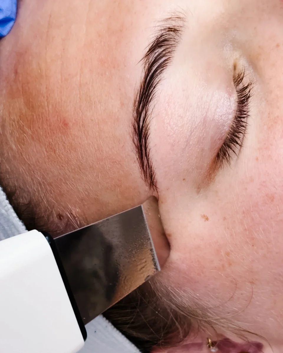 Dermasound facial treatment using ultrasonic exfoliation and infusion technology to deeply cleanse, hydrate, and brighten the skin.