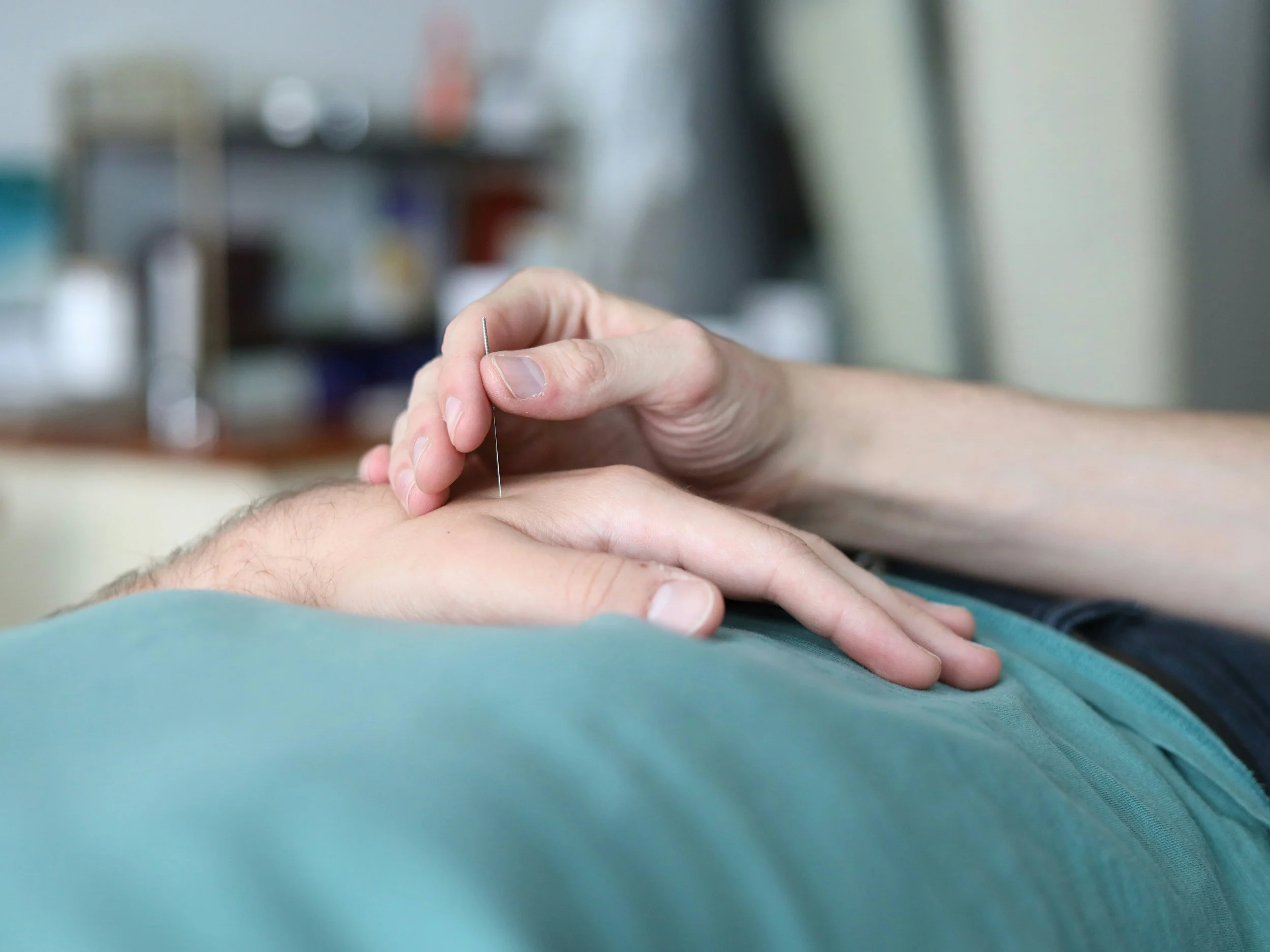 Acupuncture Service