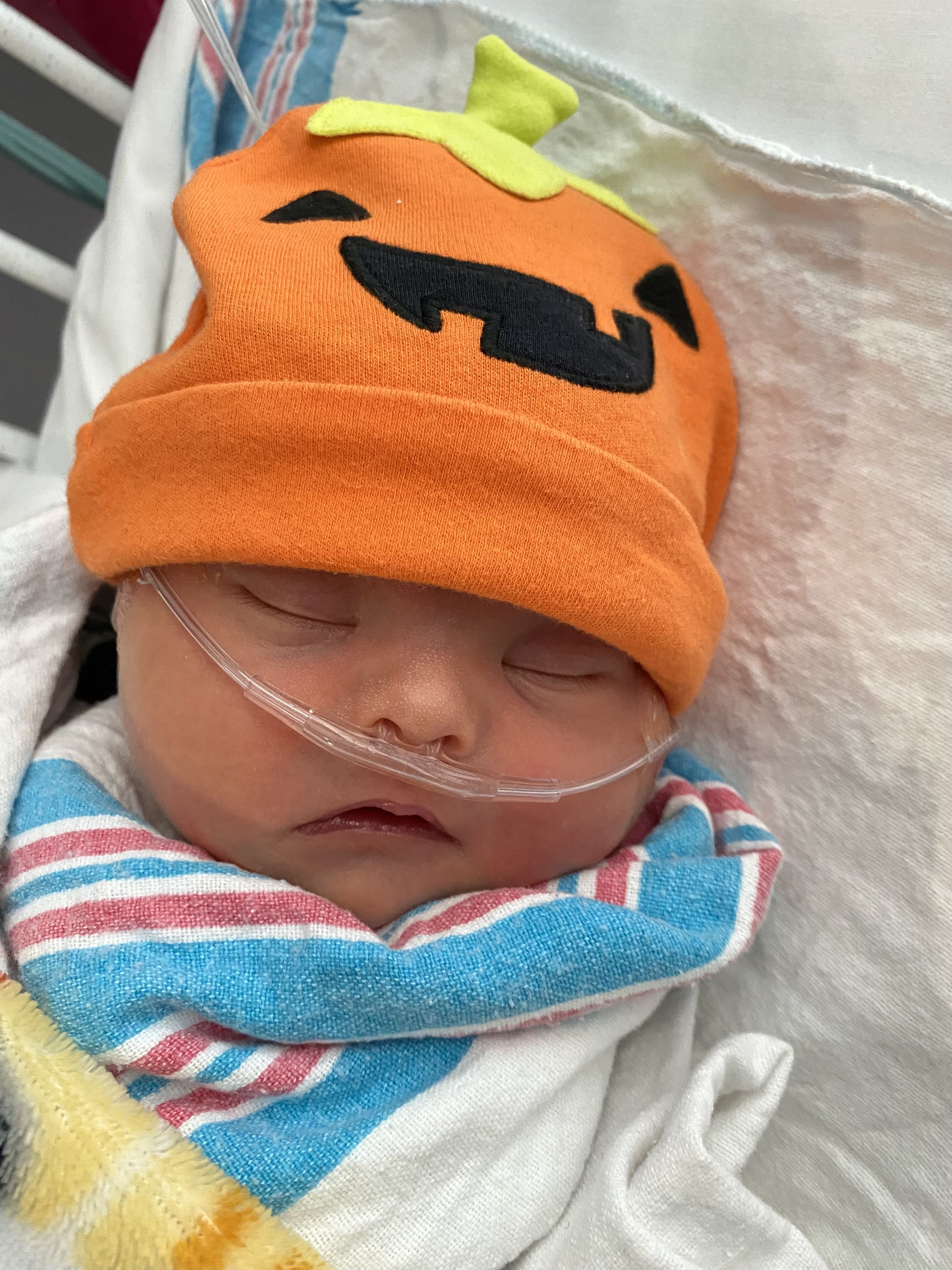 Baby Cade, born with Down Syndrome and looking cure in his pumpkin hat.