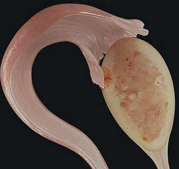 Close-up of a pink parasitic roundworm beside its oval, mottled reproductive organ or body structure on a black background