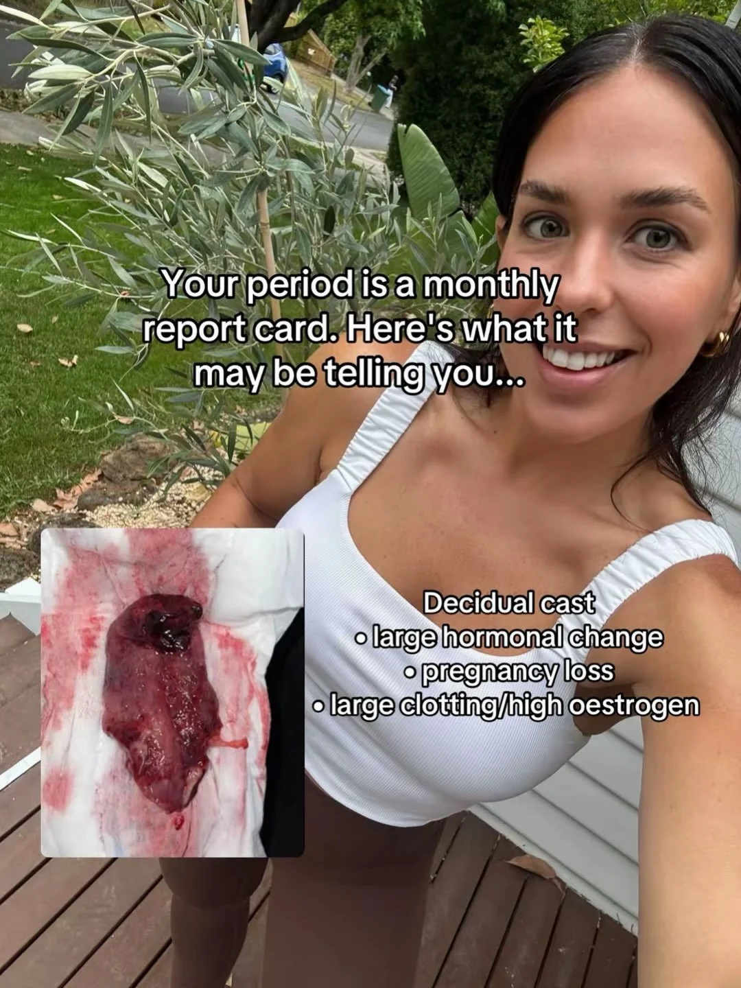 YOUR PERIOD IS ALWAYS TALKING TO YOU 🩸 

Begin listening to what it is saying. Whilst the above aren't the ONLY issues associated with these symptoms, they can be some of the most common we see. 

#periods #hormones #endometriosis #pcos #infertility