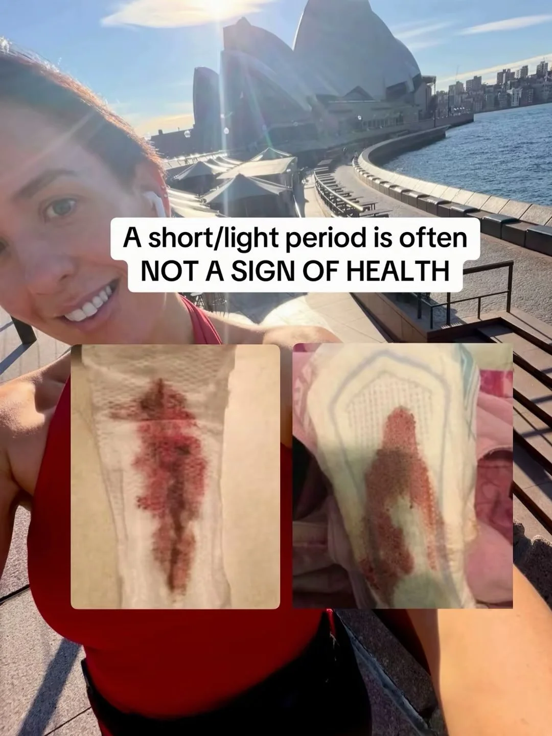 A barely-there period isn&rsquo;t automatically a gold star for cycle health. 🩸

Your bleed is the END result of what happened across the cycle before it.

Oestrogen helps build the endometrial lining. Ovulation changes the hormonal environment. The