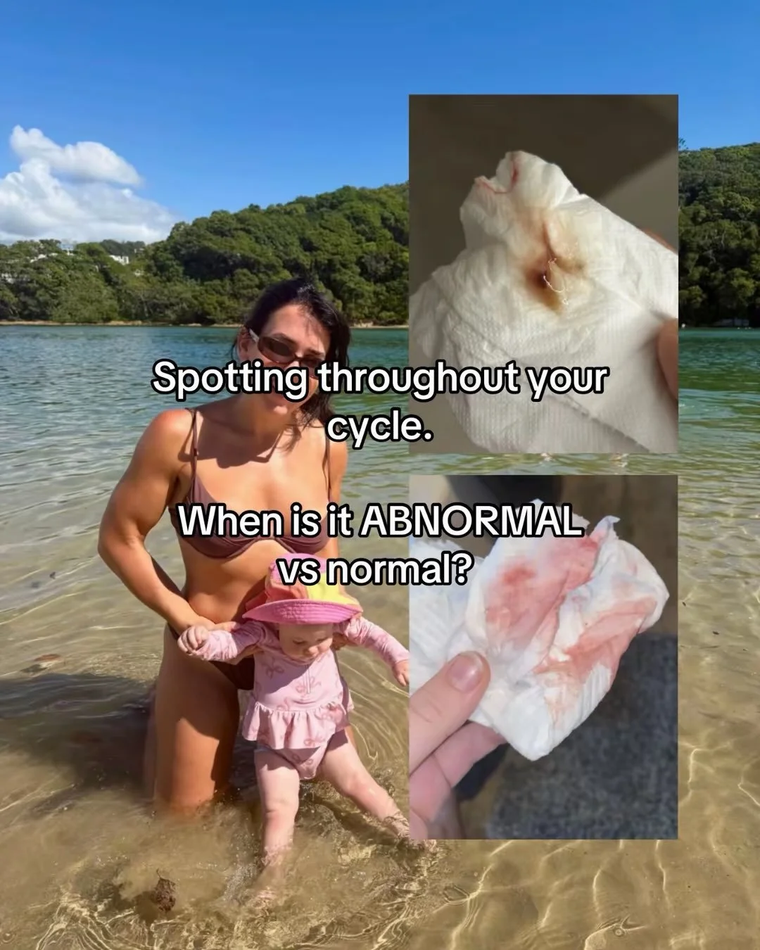 SPOTTING IS A CLUE. Not a diagnosis. 🩸 

And one of the first questions I want answered is: WHEN is it happening?

Before your period?
After your period?
Around ovulation?
After sex?
Or randomly throughout your cycle?

Because the timing can point u