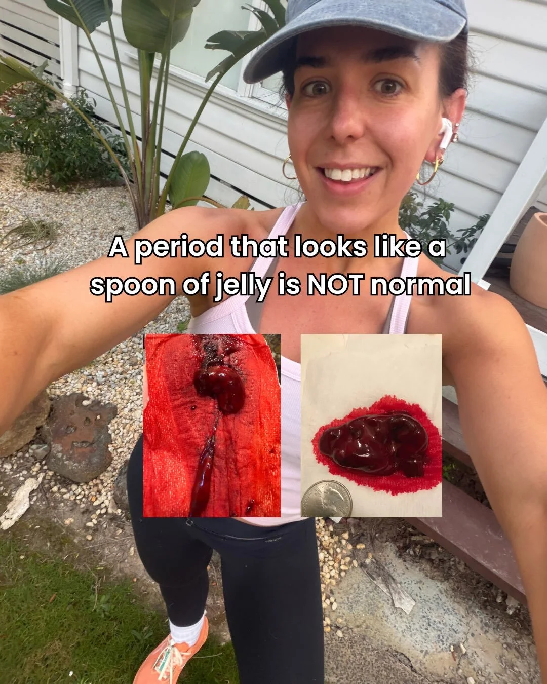 Period blood looking a little&hellip; jammy? 🍓🩸

Before you panic over what just landed in the toilet, remember: your period is NOT simply blood pouring out of your uterus.

Menstrual fluid contains blood + endometrial tissue + fluid + cellular mat