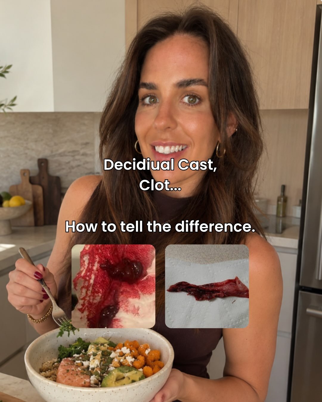 Clot or cast?

🩸 A clot is coagulated bleeding. Typically dark red, jelly-like and irregular in shape.

🩸 A decidual cast is your uterine lining shedding in one relatively intact piece. Often fleshy, rubbery and sometimes triangular in appearance.
