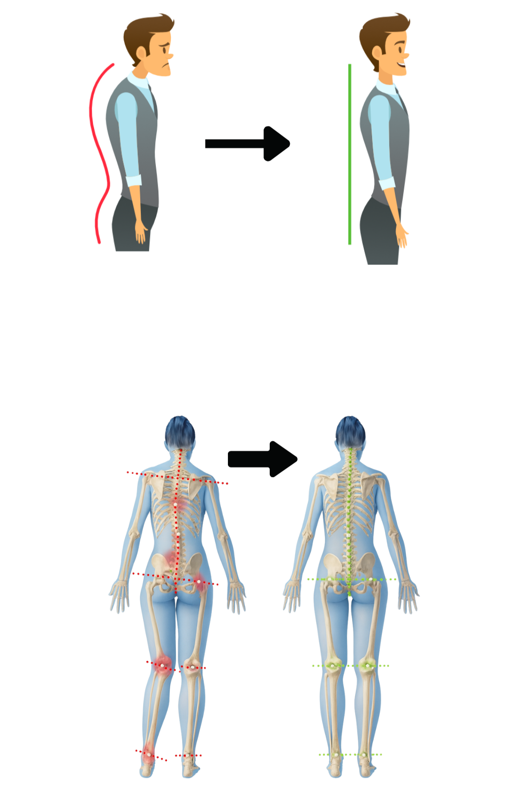 Illustration comparative de posture et de la colonne vertébrale, montrant une mauvaise posture avec une colonne courbée et des points douloureux, puis une posture corrigée avec une colonne alignée.