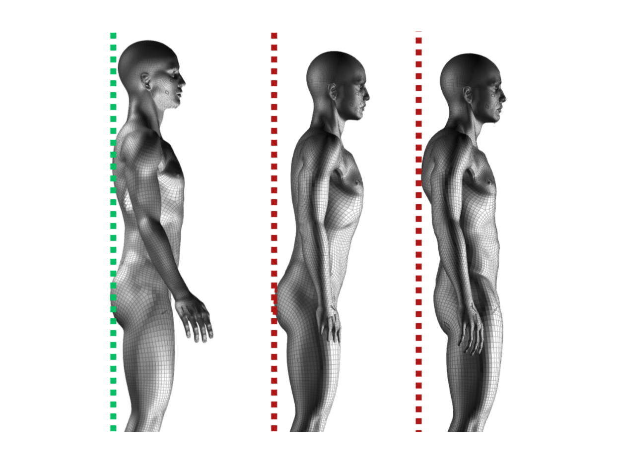 Diagramme montrant la progression d'une silhouette humaine 3D de face à droite à gauche, avec des couleurs vert, rouge, violet, sous différentes zones