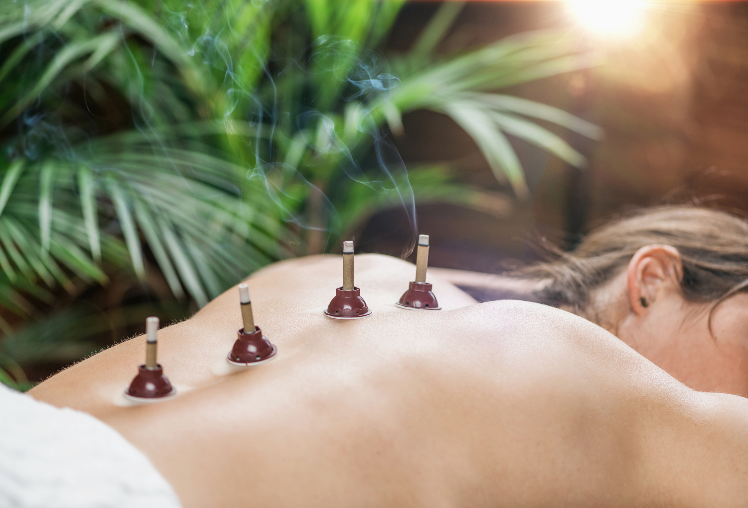 Warm moxibustion moxa therapy applied to acupuncture points for circulation and chronic pain
