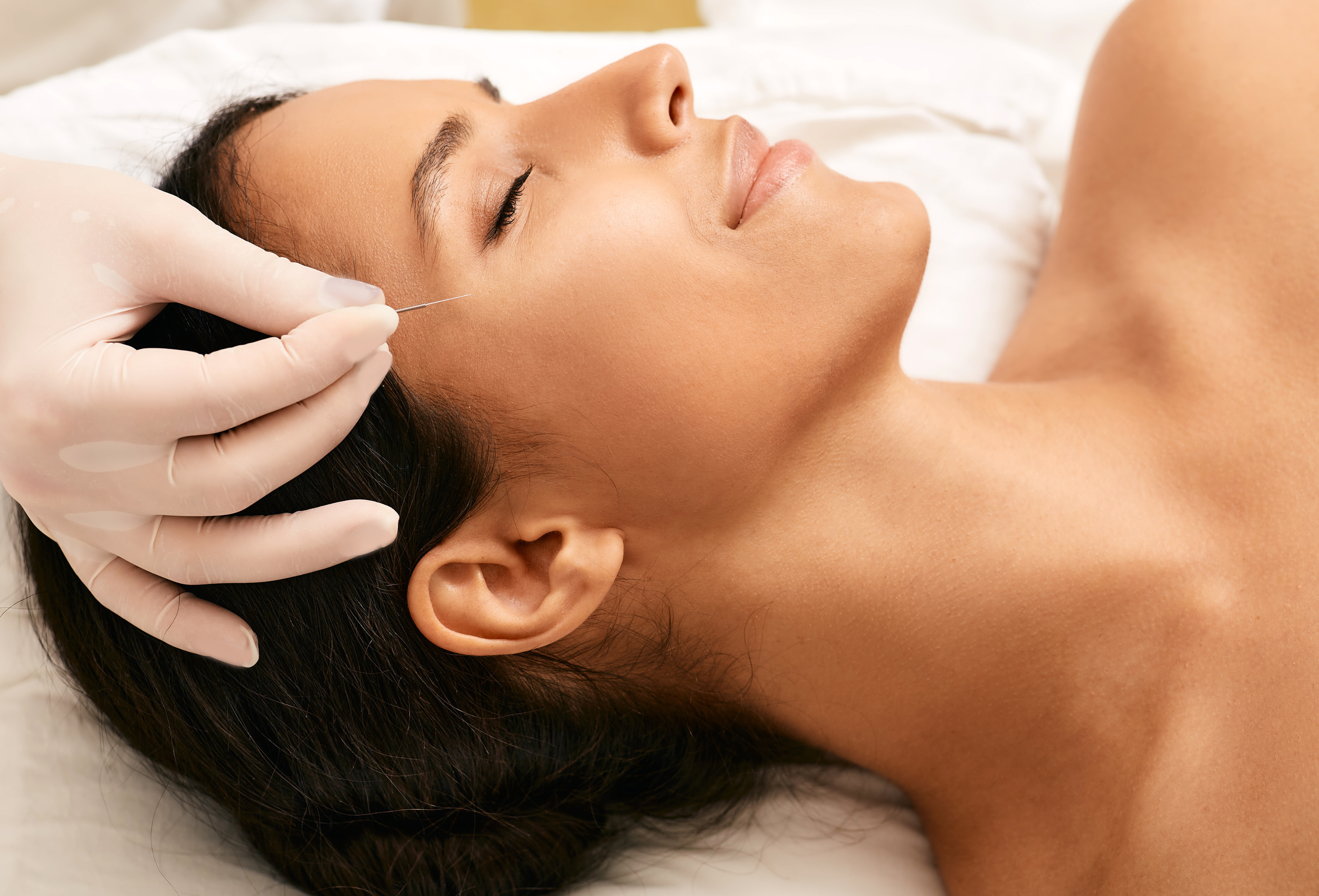 Licensed practitioner inserting a facial acupuncture needle for TMJ and jaw pain relief in San Diego