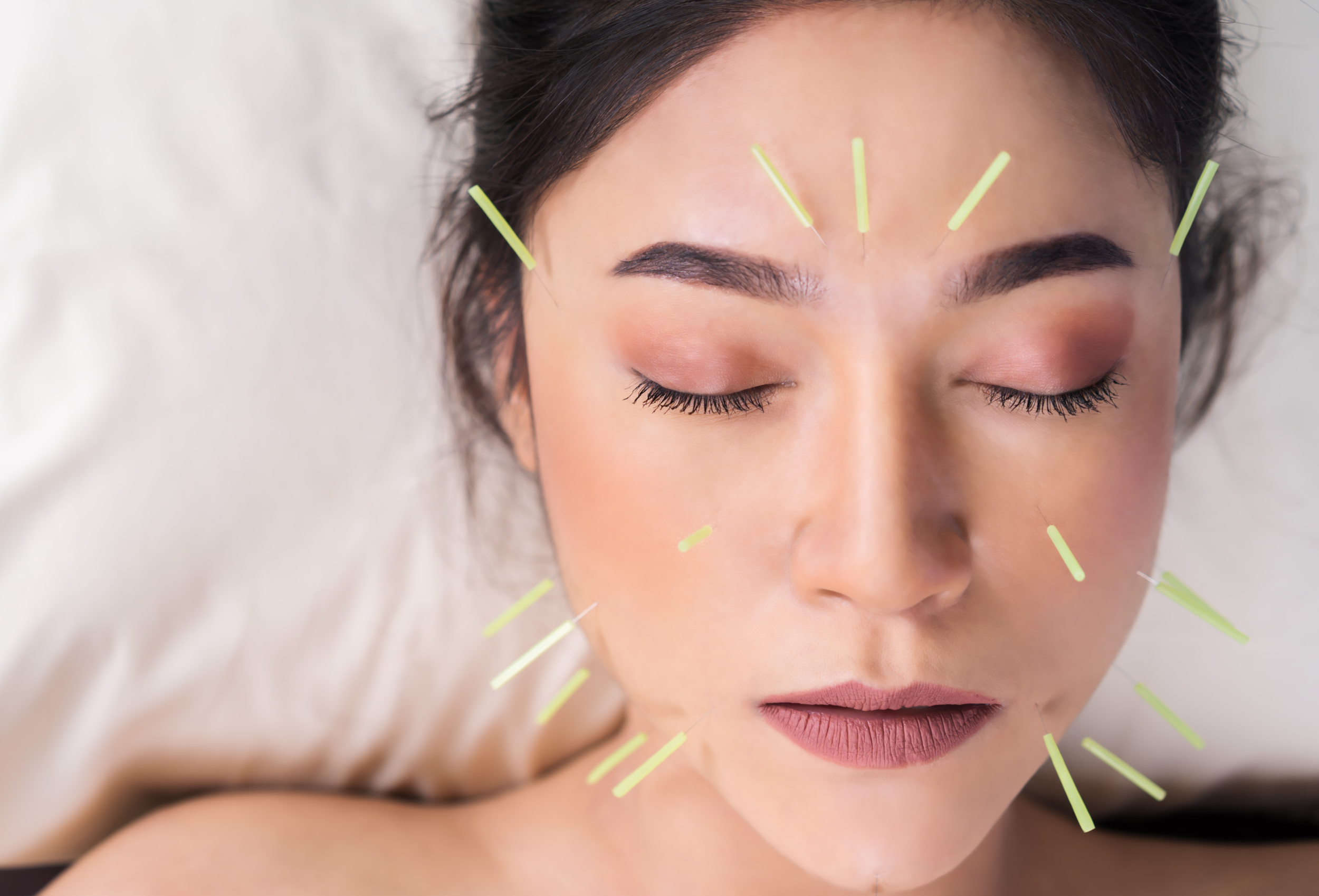 Facial acupuncture natural skin health San Diego