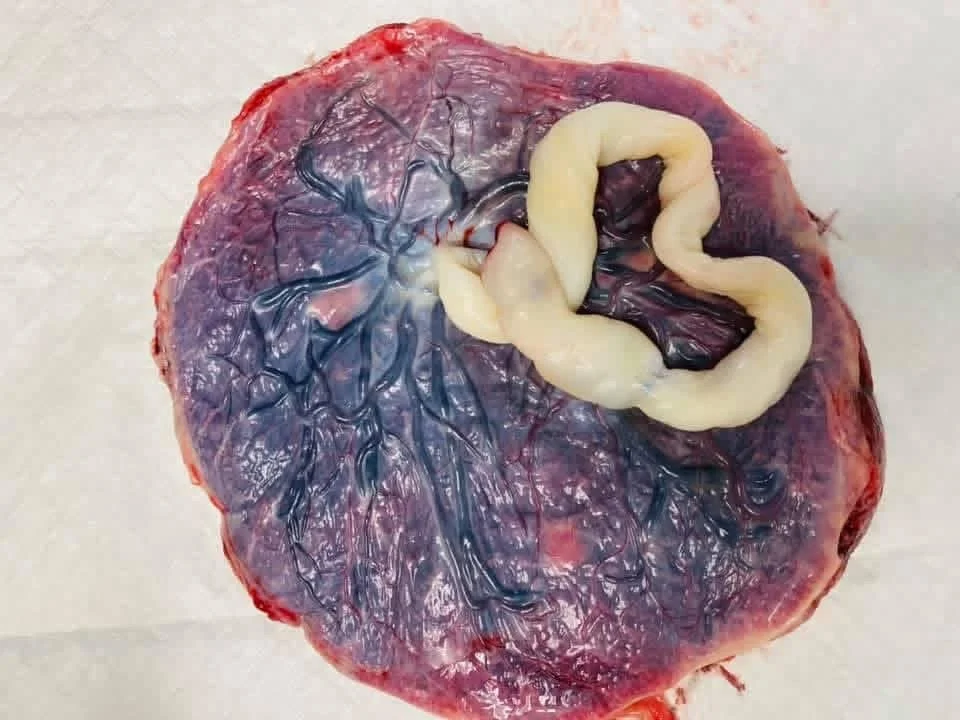Cross-section of a pig's heart with visible blood vessels and a parasitic worm on top.