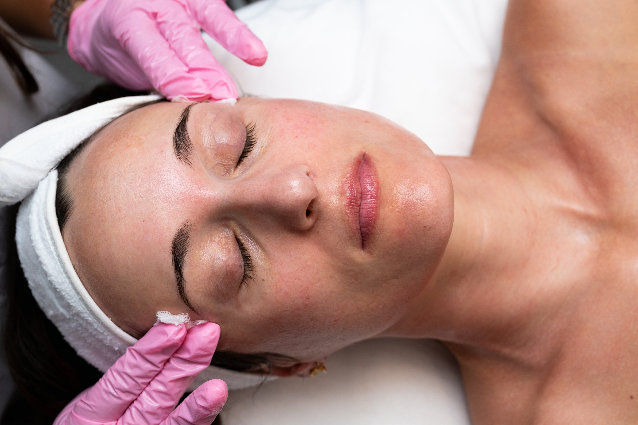 Bella Derma provider performing a professional facial treatment.