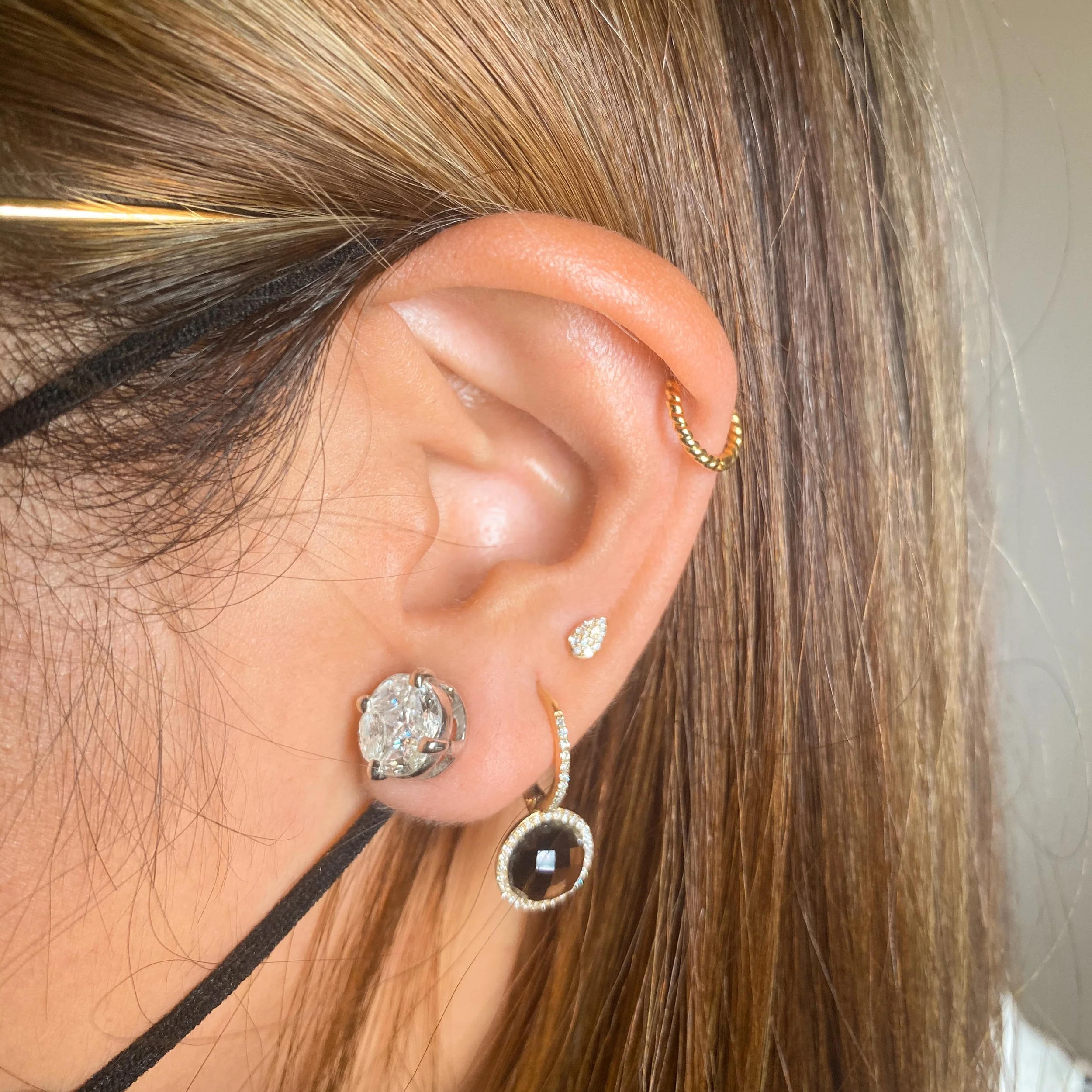 Helix and Custom Upper Lobe