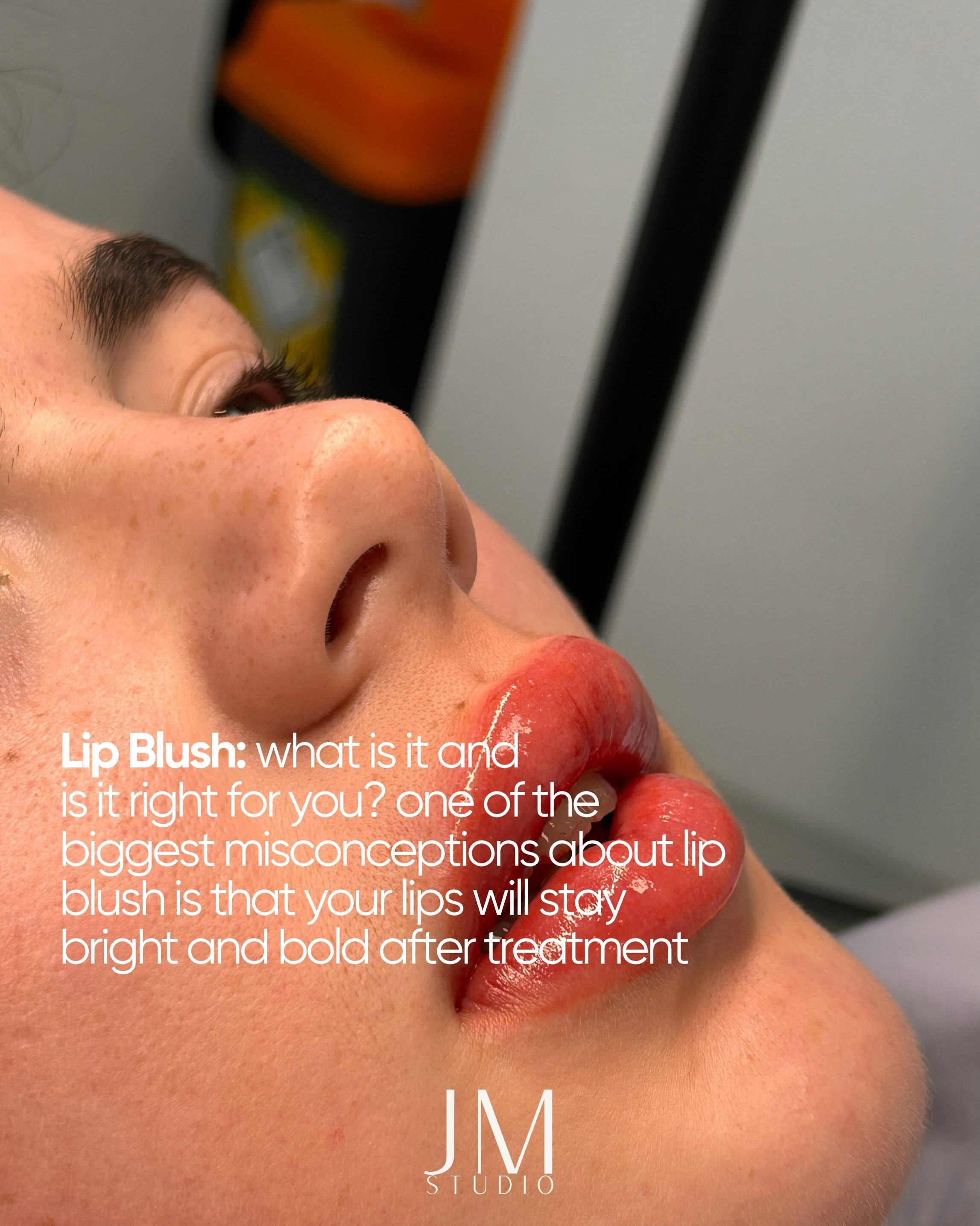 The goal isn&rsquo;t lipstick.  it&rsquo;s beautifully enhanced lips that still look like you. 🤍