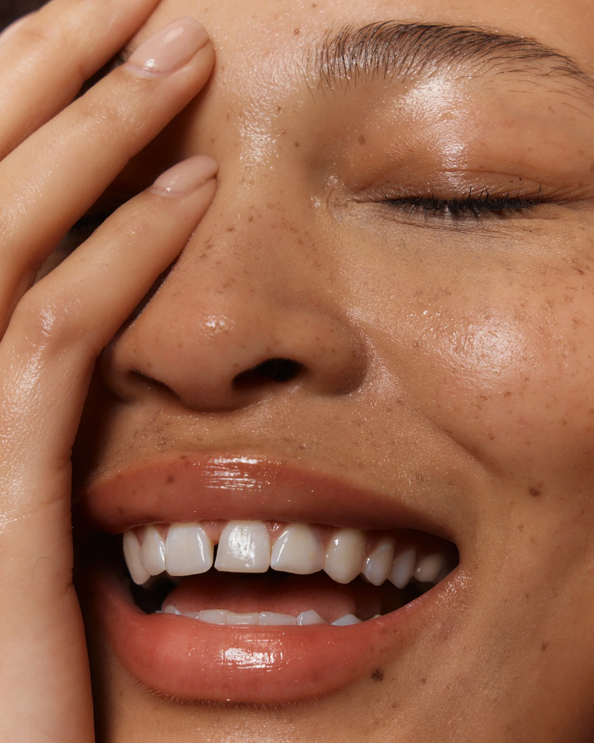 Close-up of a person with a big smile, showing white teeth, with one hand touching the cheek and eye closed.