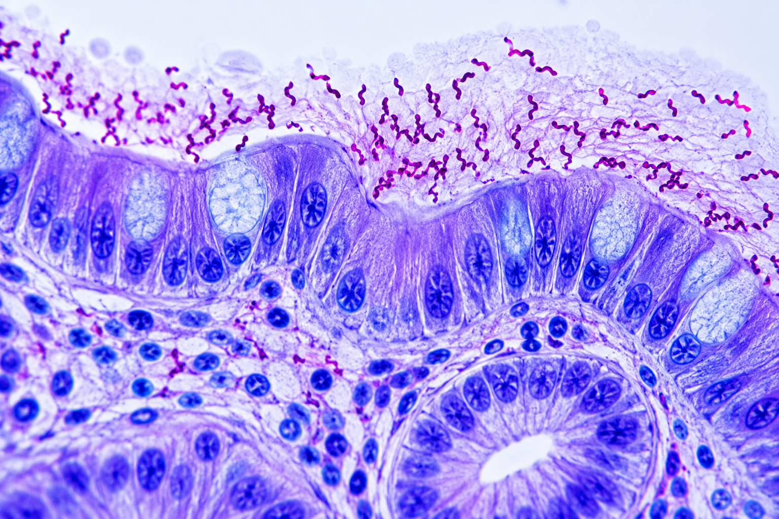 Microscopic view of intestinal tissue with purple-stained cells and structures, including villi and goblet cells.