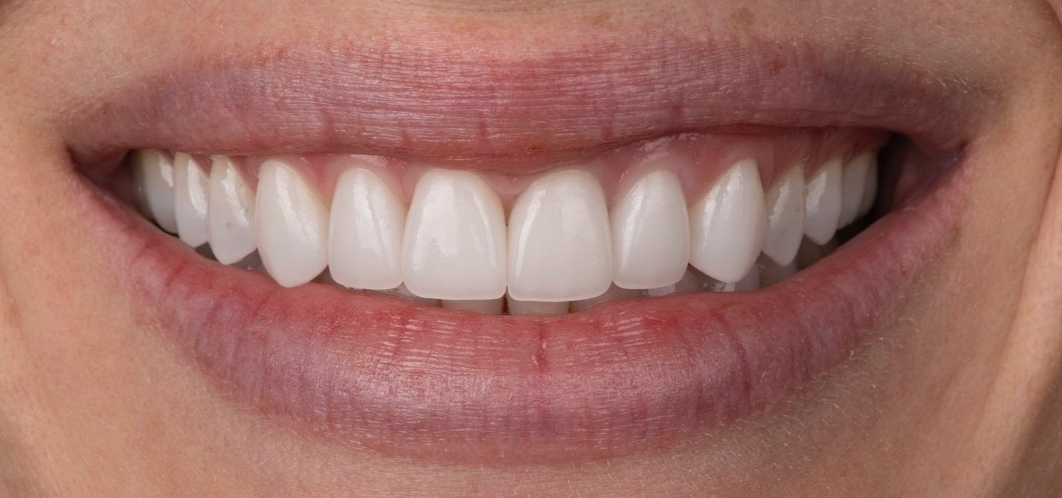 MicroDental_Case.png