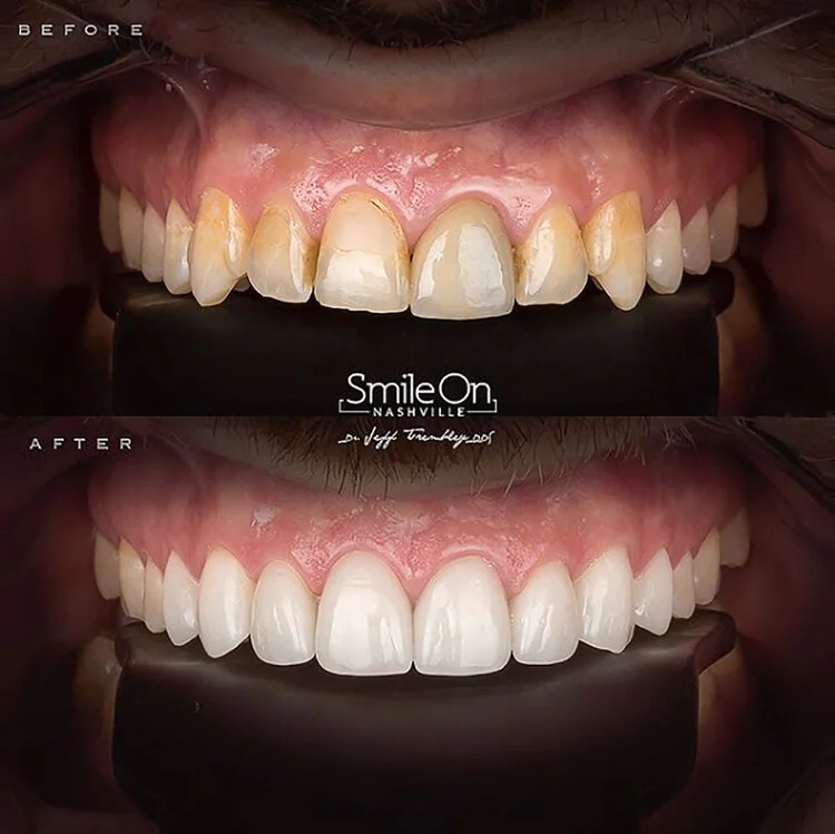 Dr_Trembley_Before_After.jpg