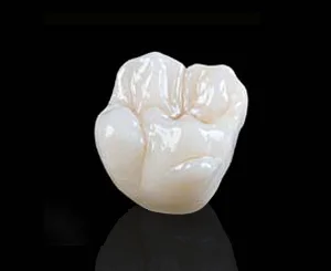 PFZ Porcelain Fused to Zirconia (Copy)