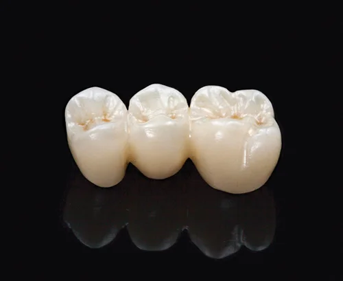 FCZ Full Contour Zirconia (Copy)