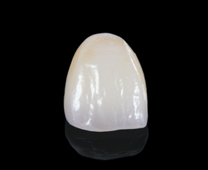 Quantum IPS e.max (Copy)
