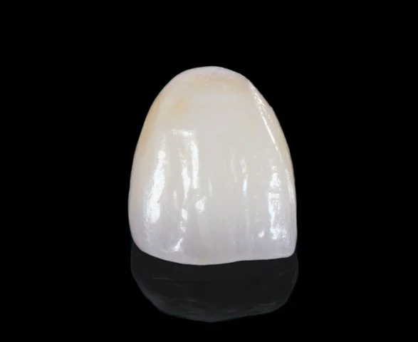 E.MAX® (Copy)
