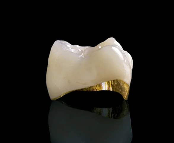 PFM (Copy)