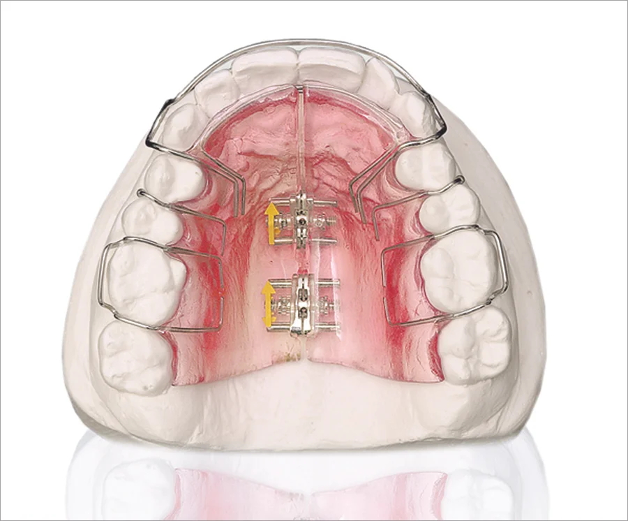 orthodontics.jpg