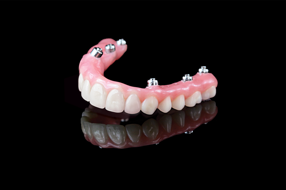 HYBRID DENTURE (Copy)