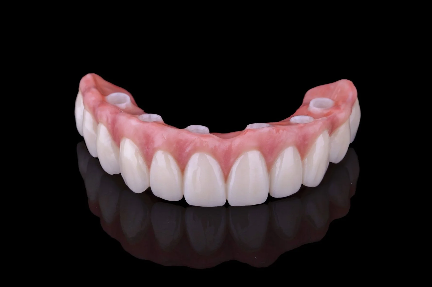IMPLANT-SUPPORTED ZIRCONIA BRIDGE (Copy)