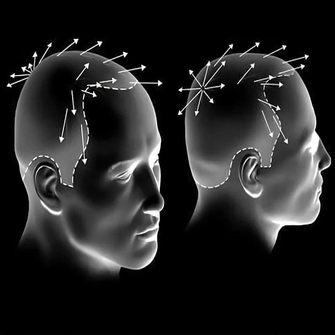 The Architecture of Realism: Why Graft Direction and Angulation Dictate Hair Transplant Results