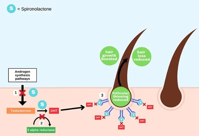 Diagram showing the effects of spironolactone on hair follicles, including hair growth stimulation, hair loss reduction, and follicular thinning reduction through the androgen synthesis pathways, with labels for DHT, testosterone, and enzymes.