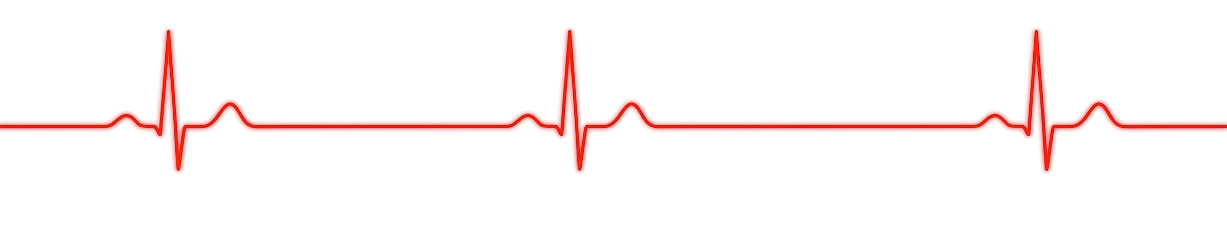 Electrocardiogram (ECG) tracing showing normal heart rhythm with two prominent P waves, QRS complexes, and T waves.