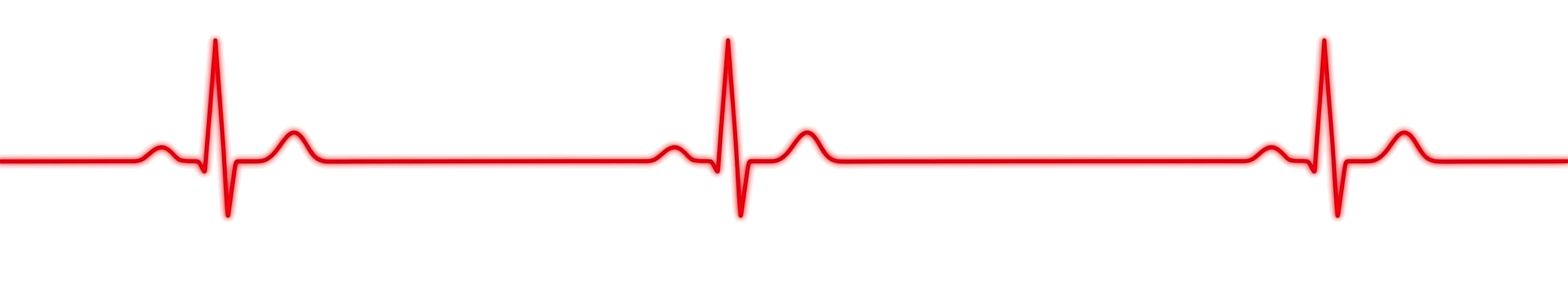 Electrocardiogram (ECG) displaying heart activity with peaks and irregularities.