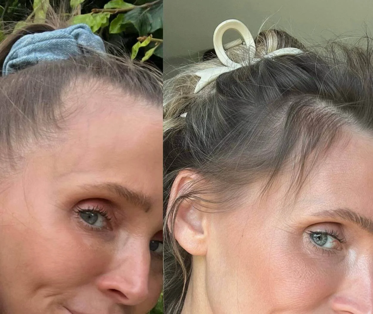 Vergleich zweier Frauen, vor und nach einer Schönheitspflege, Nahaufnahme von Gesichtern, Fokus auf Augen und Stirn, sichtbare Haaraccessoires und Haarfarben, natürliche Hauttöne.