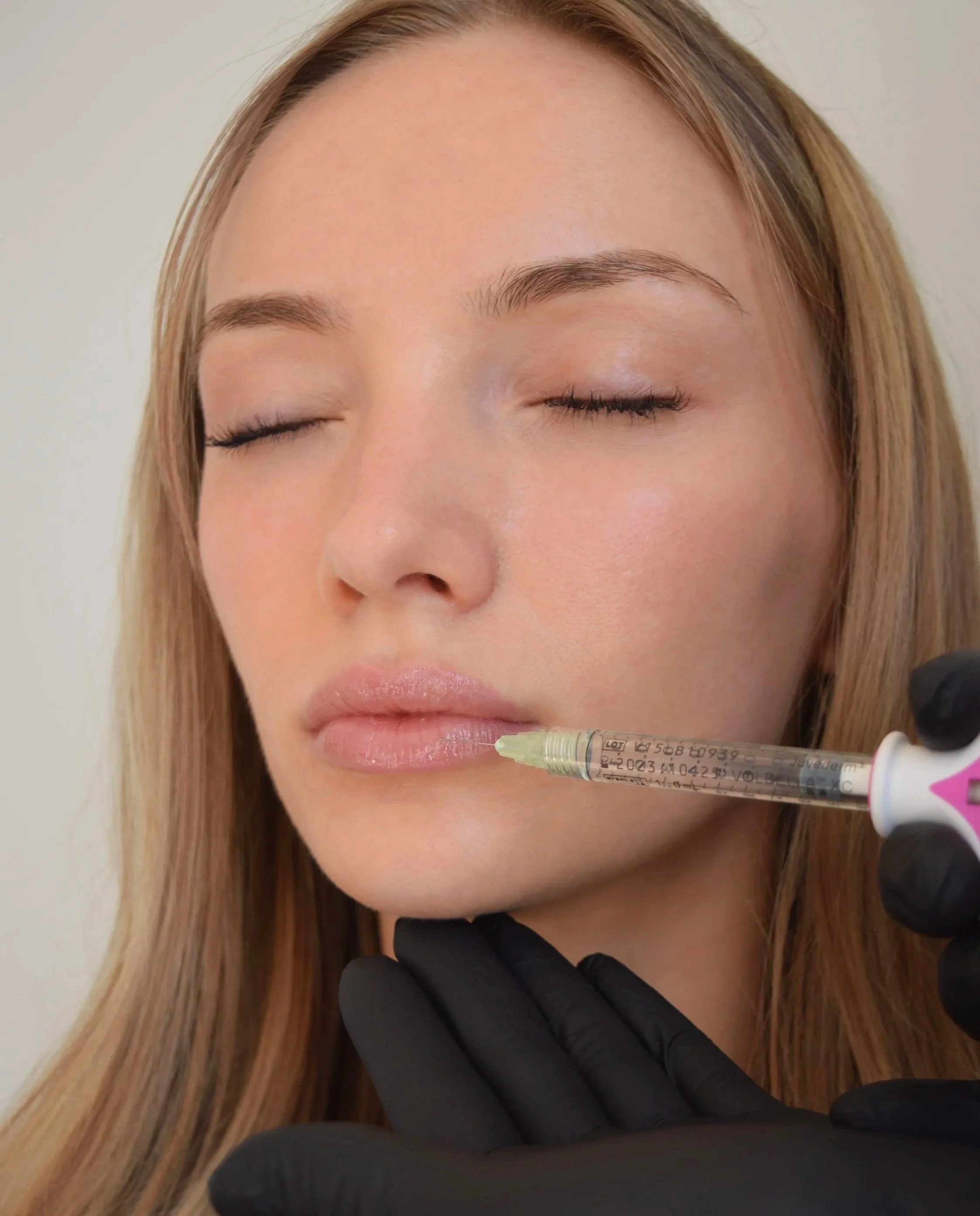 Lip filler