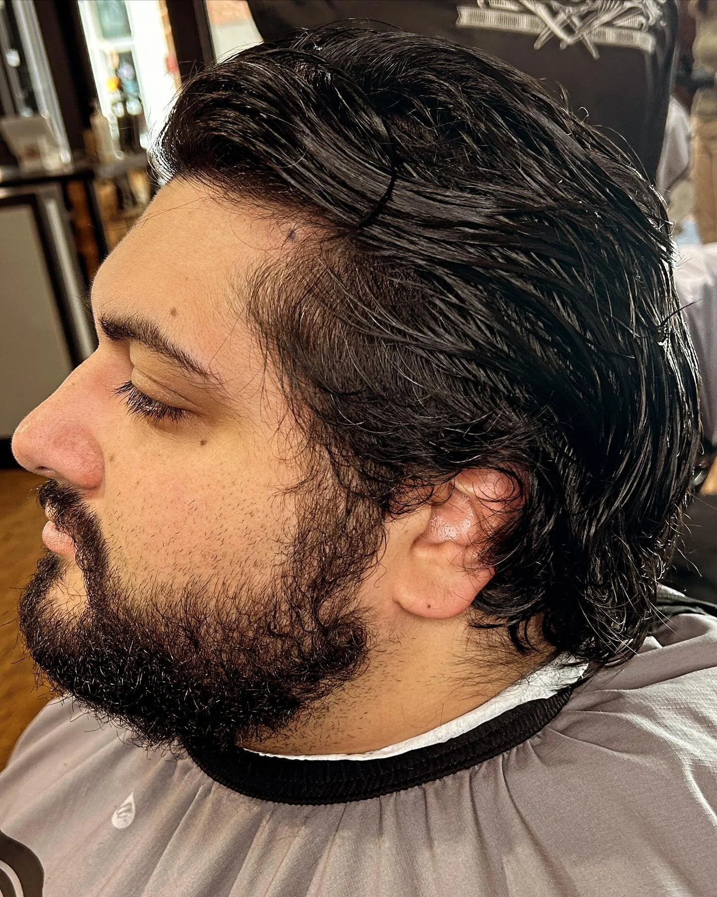 Before VS After 💈