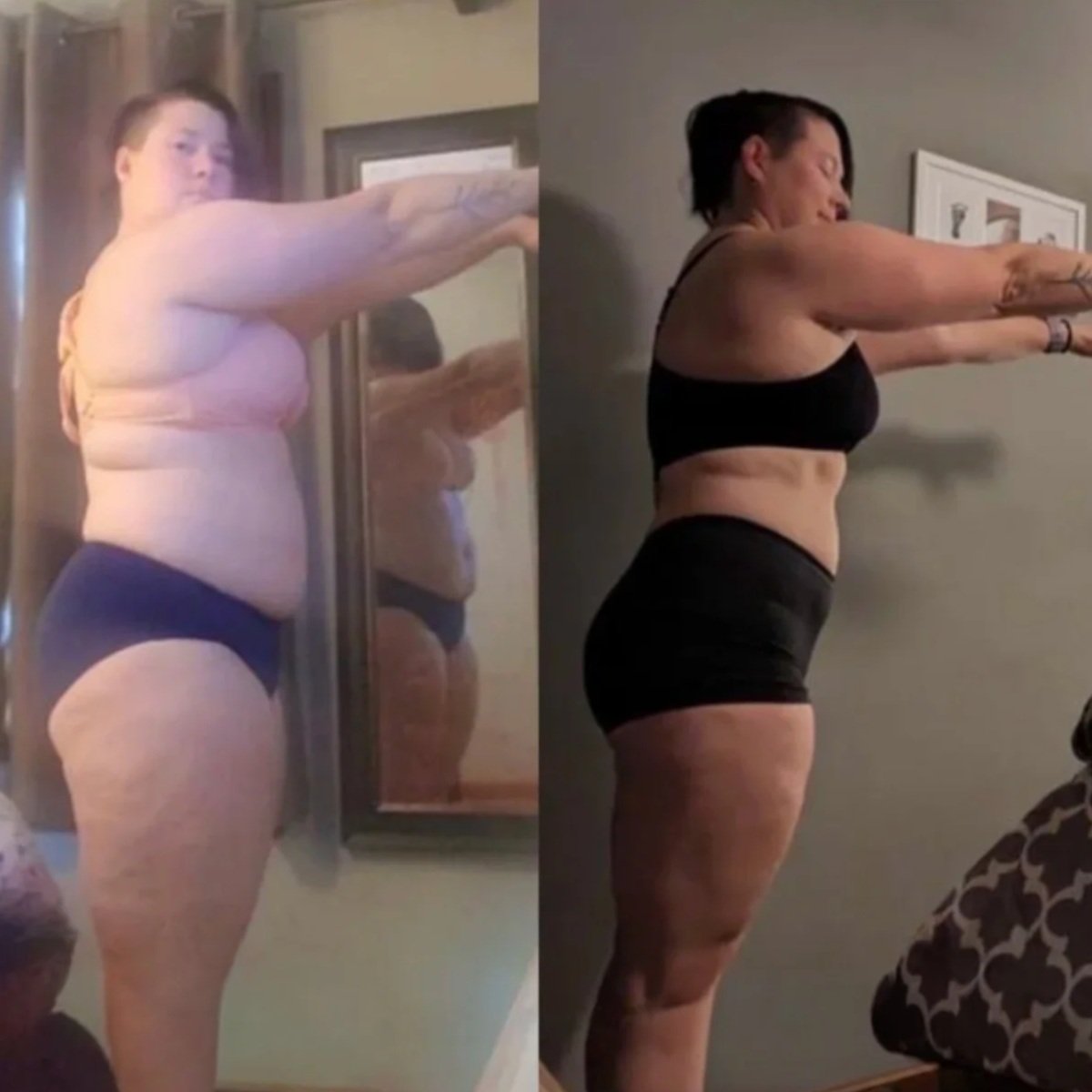 Side-by-side comparison of a woman before and after weight loss, showing progress in body transformation.