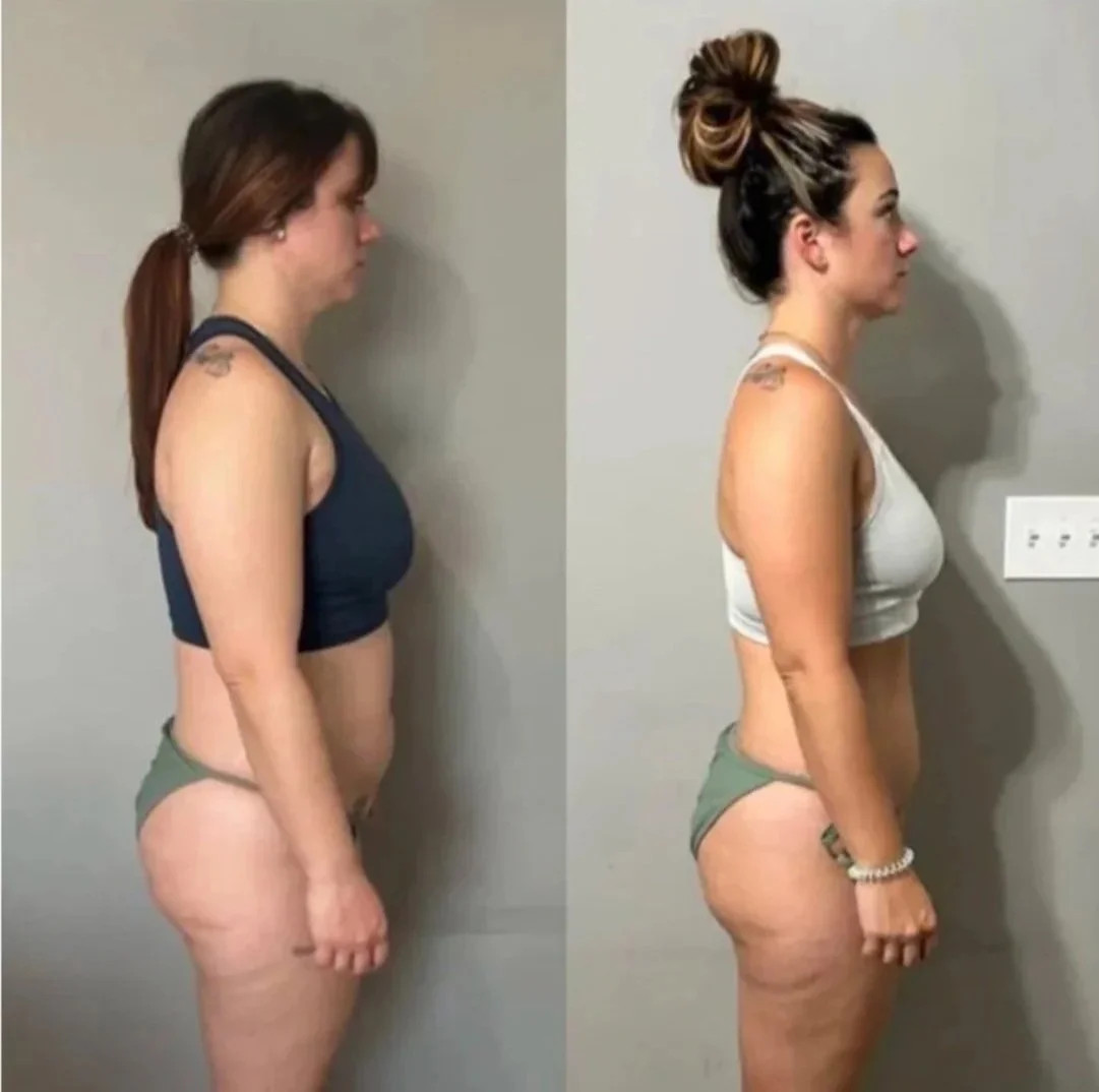Side-by-side comparison of a woman before and after weight loss, standing against a gray wall in profile view.