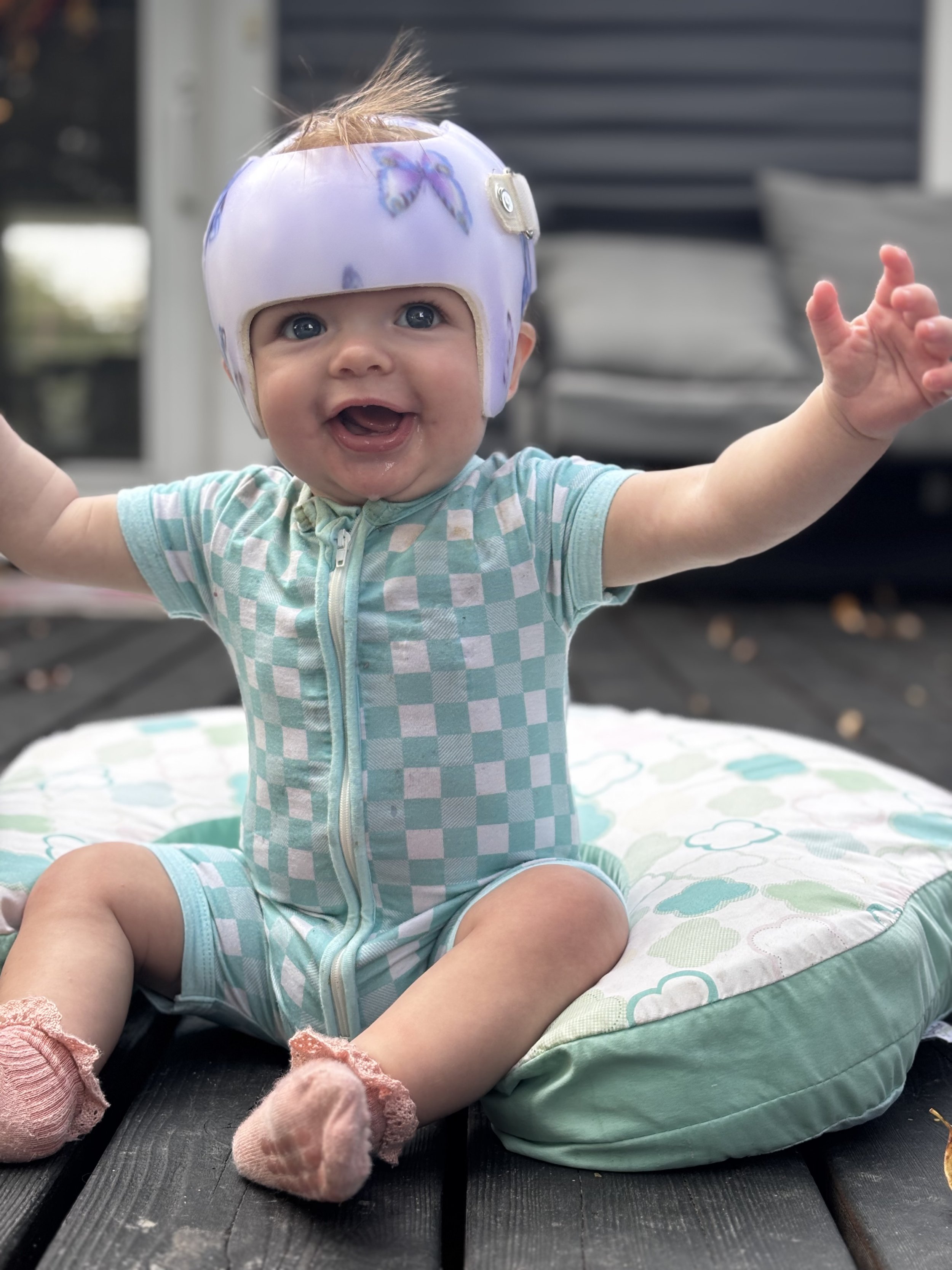 A smiling baby wearing a butterfly cranial remolding helmet and a checkered onesie, sitting on a patterned cushion on a wooden surface, with arms outstretched and feet in pink socks.