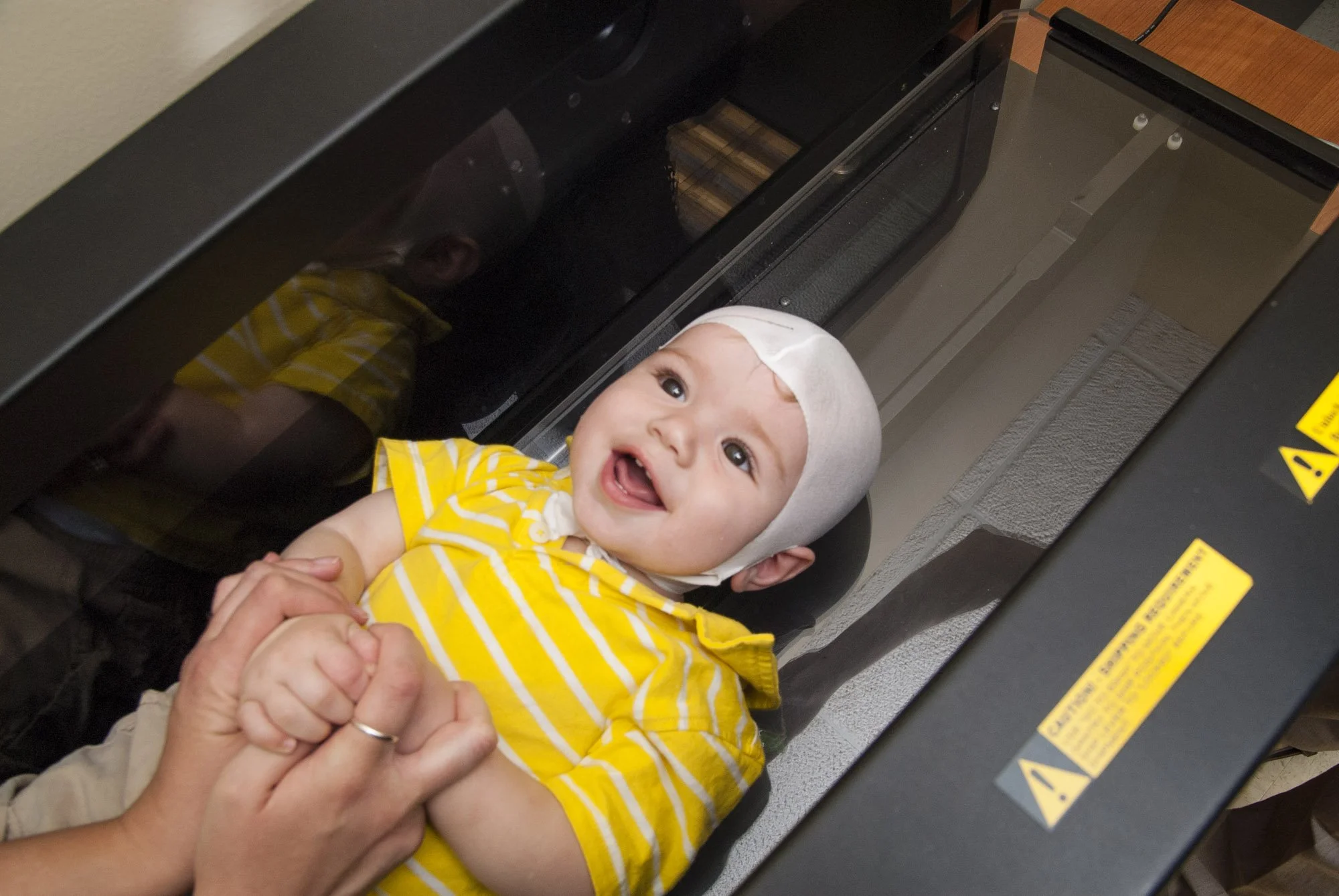 A smiling baby wearing a white stockinette cap and yellow striped shirt, being held with hands clasped together while lying inside a STARscanner, which is used to capture a 3D image of the baby's head.