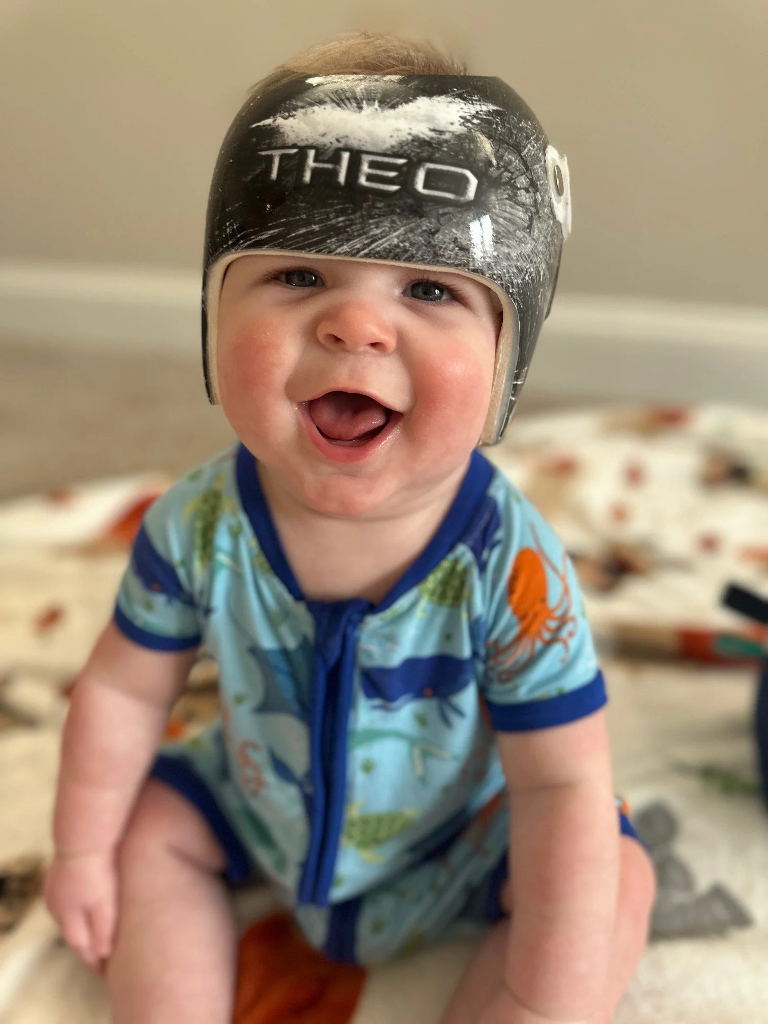 A young baby wearing a cranial remolding helmet smiling while sitting with a blurred background.