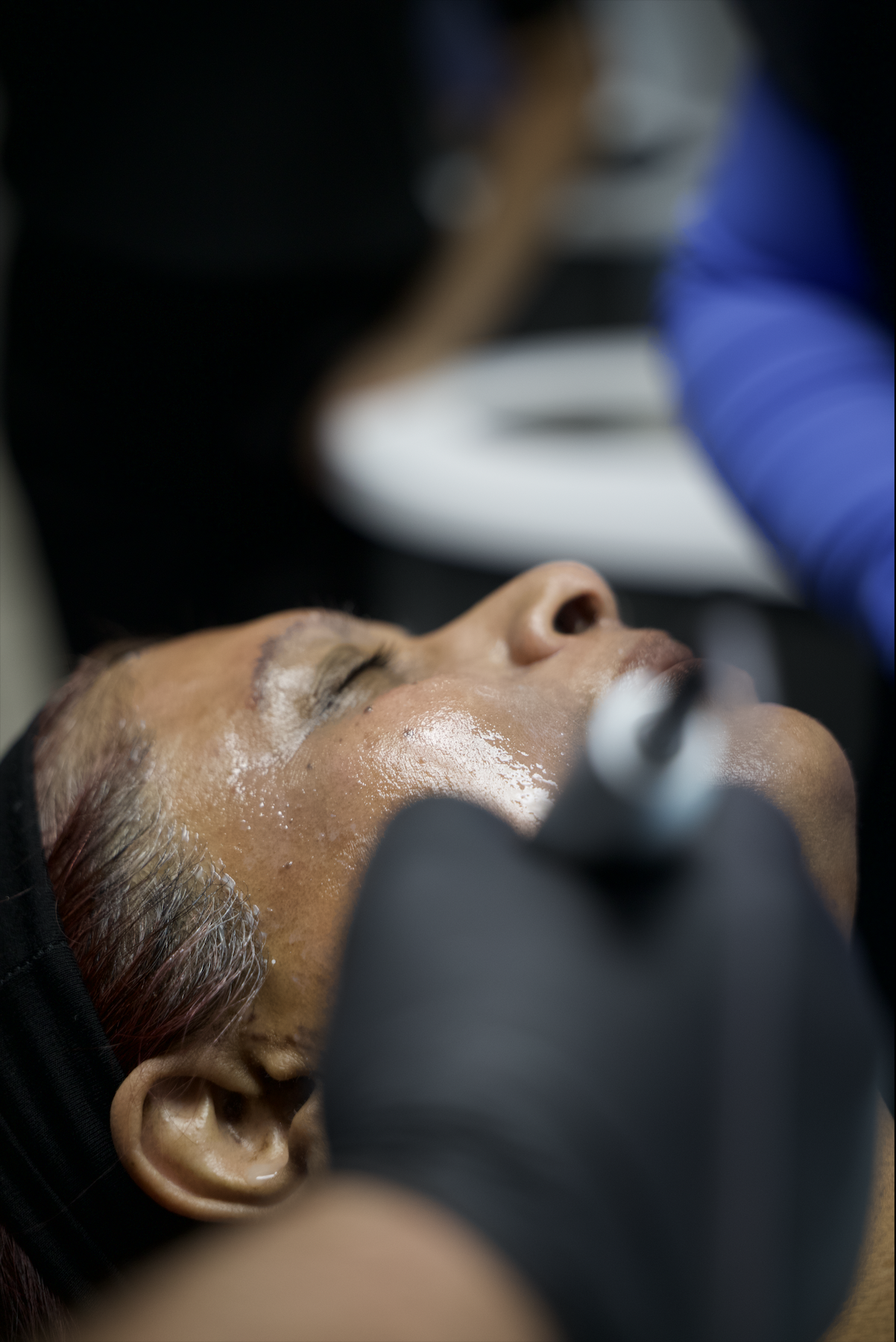 Close-up of a woman receiving a facial treatment, lying down with a facial mask applied, while a professional in blue gloves applies a procedure.